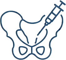 Outline illustration of a pelvic bone with a syringe injecting into the hip joint, representing a medical procedure or injection in the hip area.